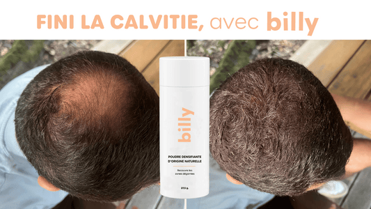 Poudre densifiante cheveux : la solution express pour retrouver du volume