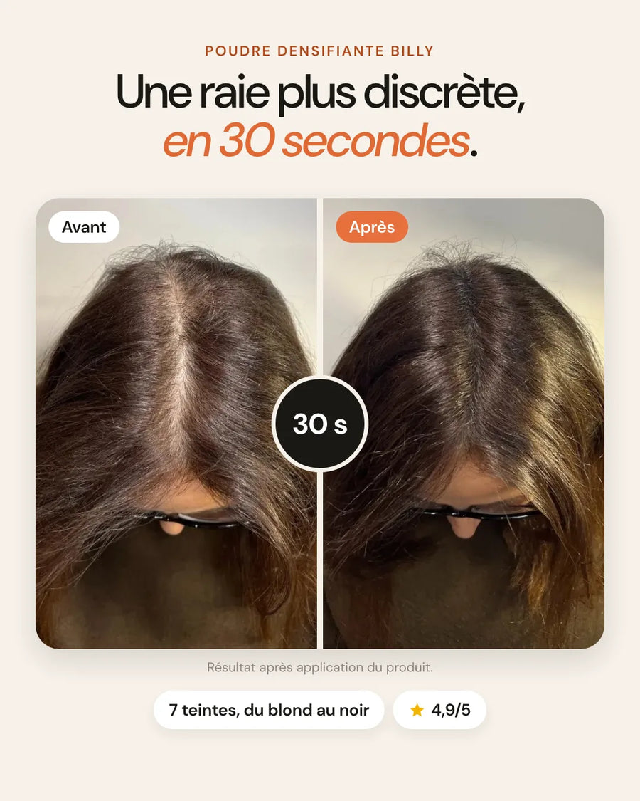 Avant/après poudre capillaire BILLY sur une raie de femme qui s'élargit, résultat en 30 secondes